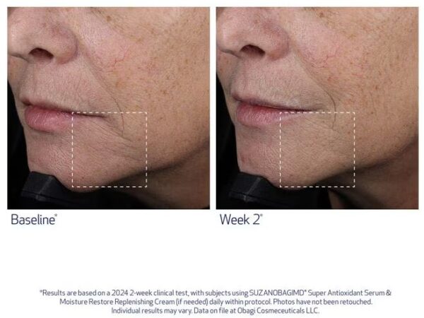 SUZANOBAGIMD® SUPER ANTIOXIDANT SERUM | 30ml - Image 6