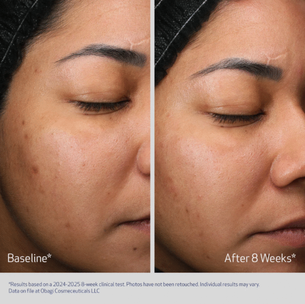 Obagi® RETINOL + PHA | 50ml - Image 5