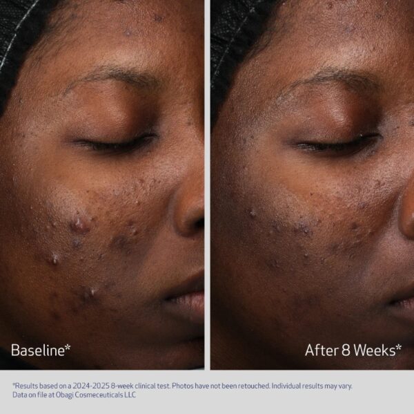 Obagi® RETINOL + PHA | 50ml - Image 6